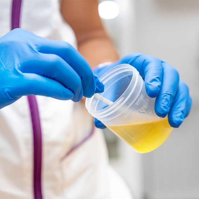 Researcher using a pipette to draw a urine sample.