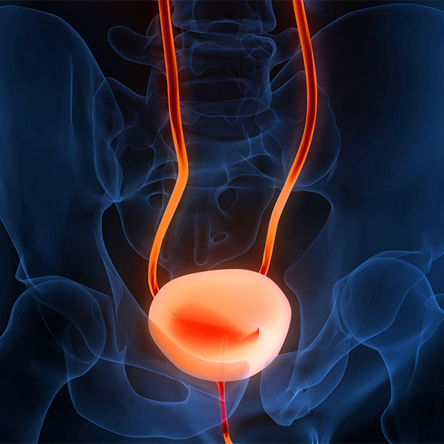 3D illustration of a bladder highlighted within the body.