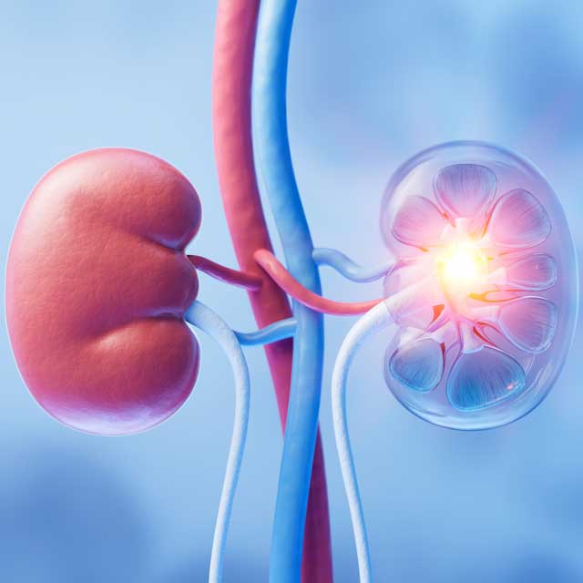 Graphic illustration of kidneys