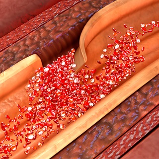 Medical illustration of coronary artery dissection