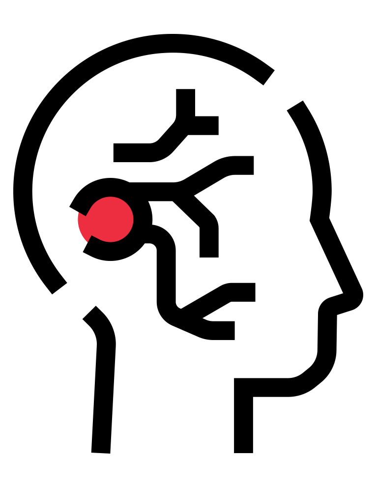 An illustration of a human head. A red dot is seen at the base of the skull. 