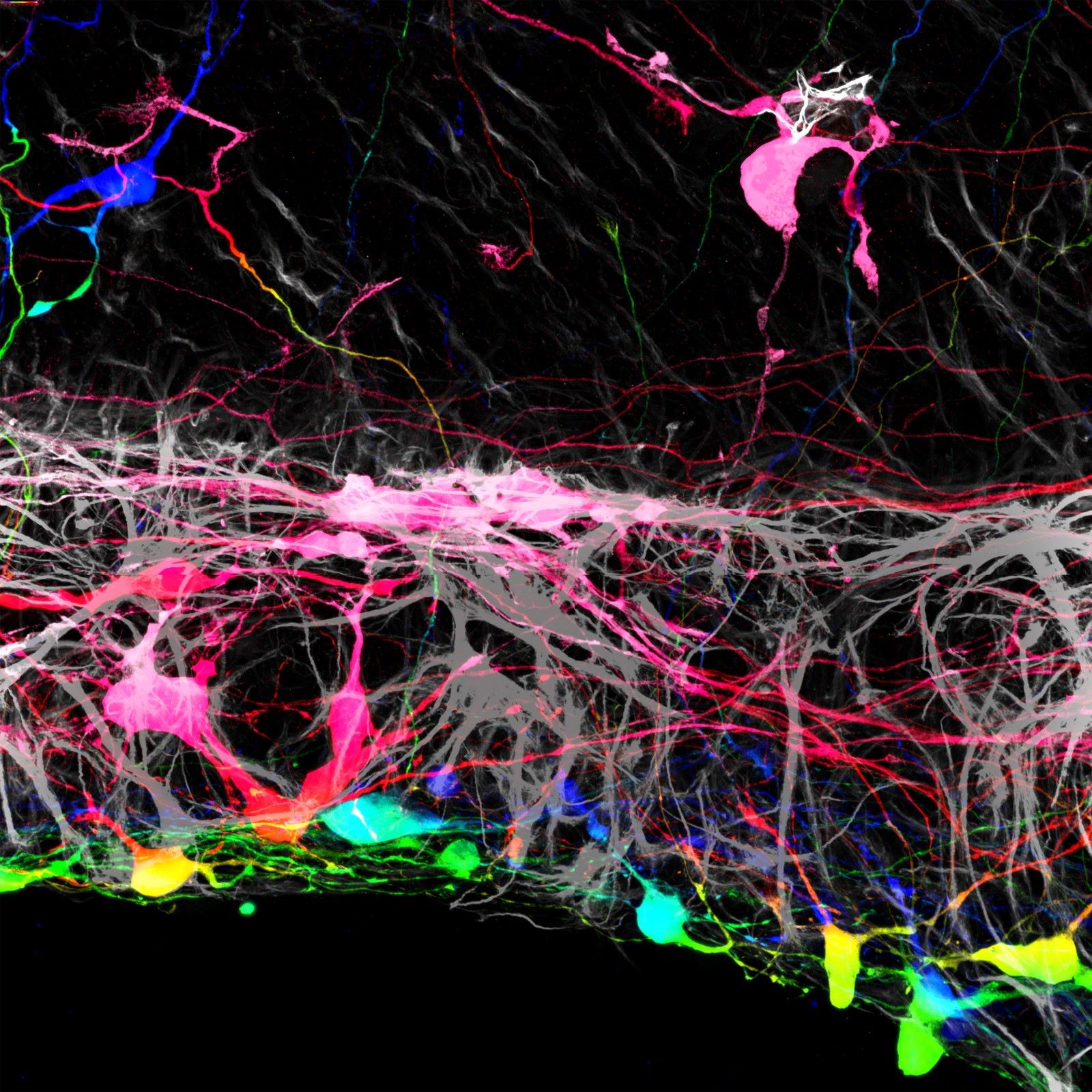 视网膜神经节细胞