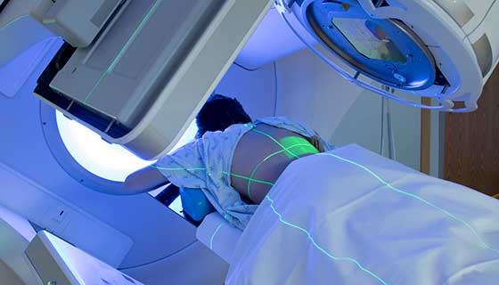 Woman undergoing radiation therapy for her back