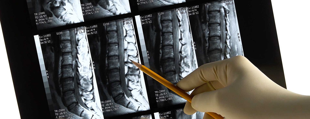 Healthcare provider pointing to a x-ray of a patient's spine.
