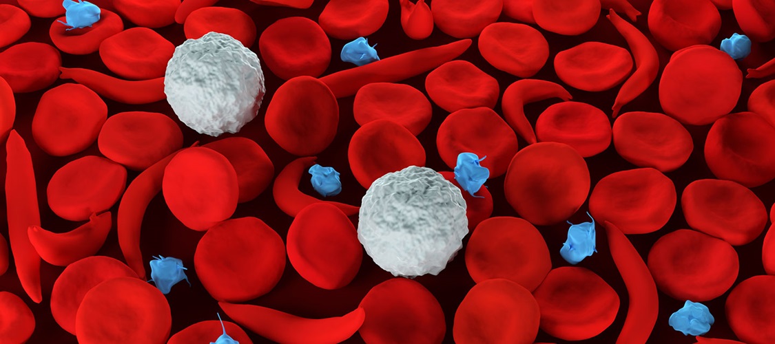 an illustration of sickle shaped blood cells