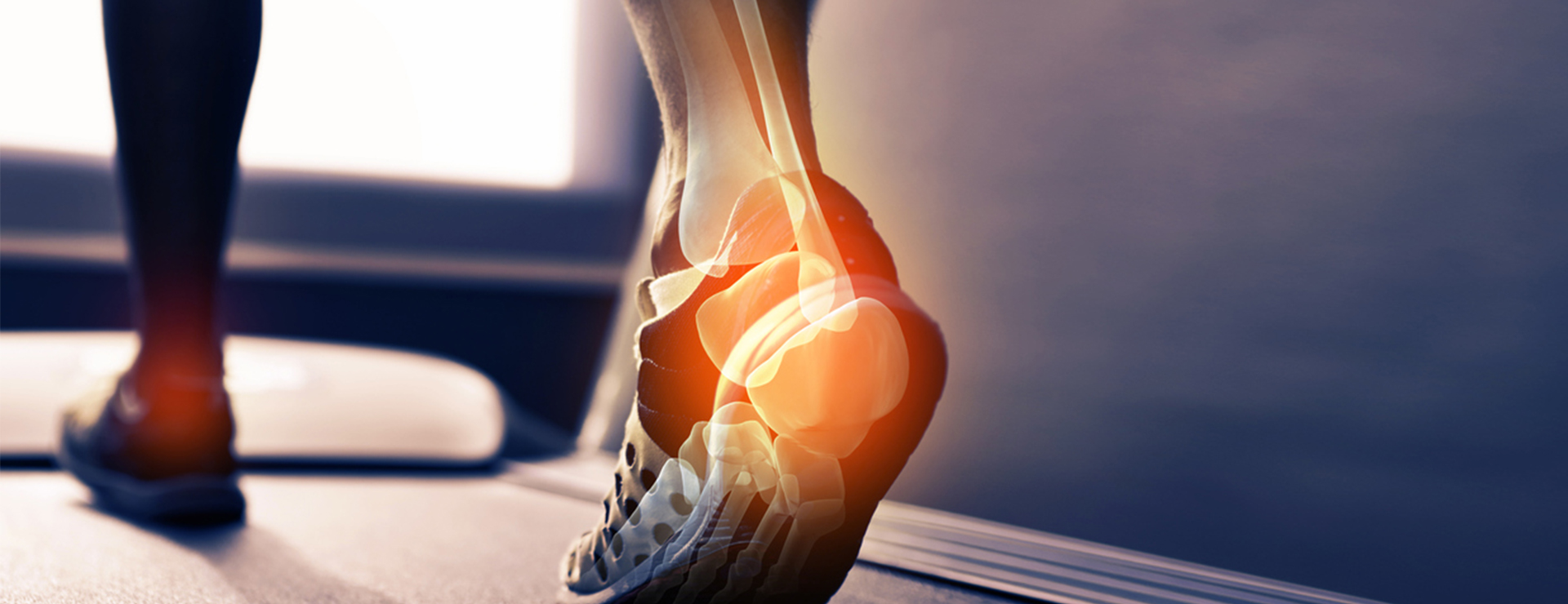 xray of foot walking