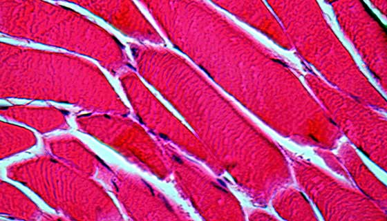 Muscle cells at 1000 times magnification