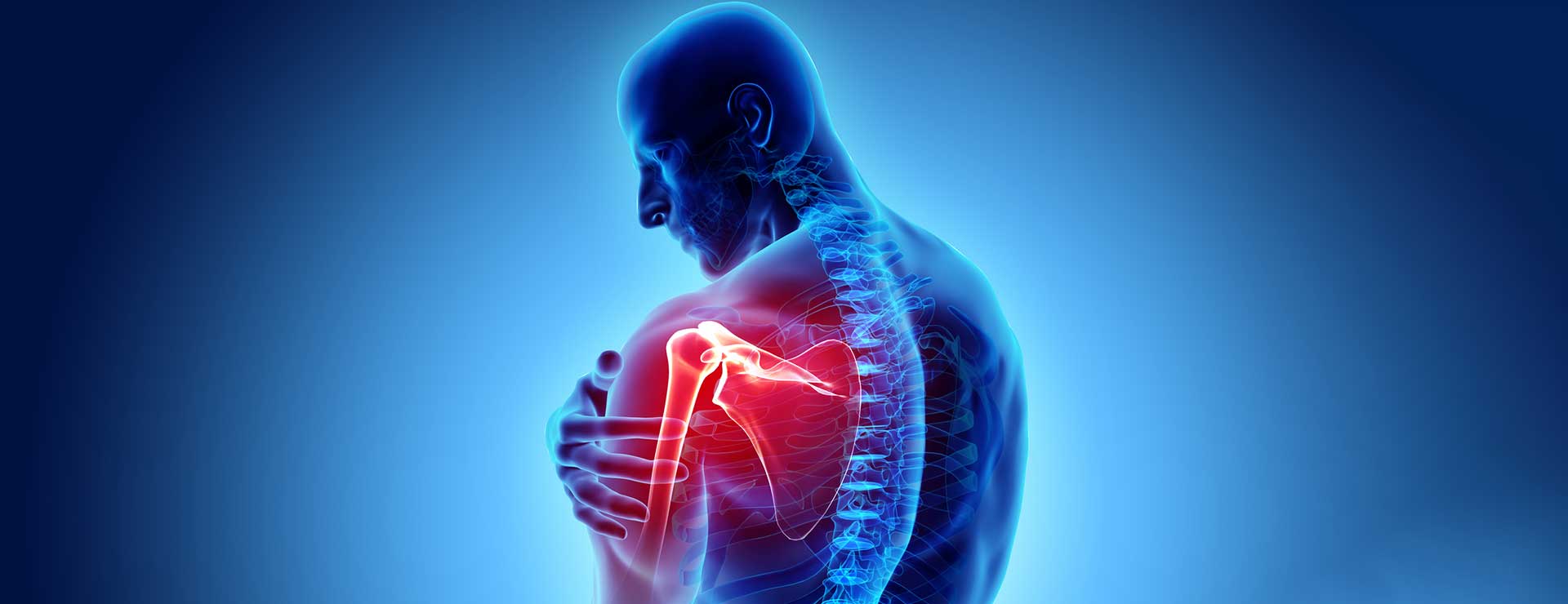 Shoulder Arthritis | Johns Hopkins Medicine