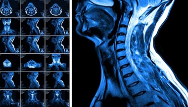 Compilation of several MRI scans of the neck