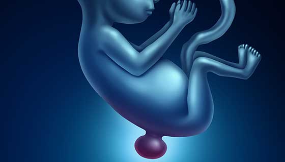 illustration of spina bifida in fetus
