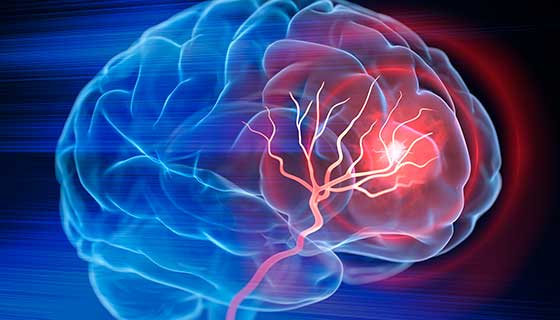 Illustrated diagram of the brain, showing blood vessels