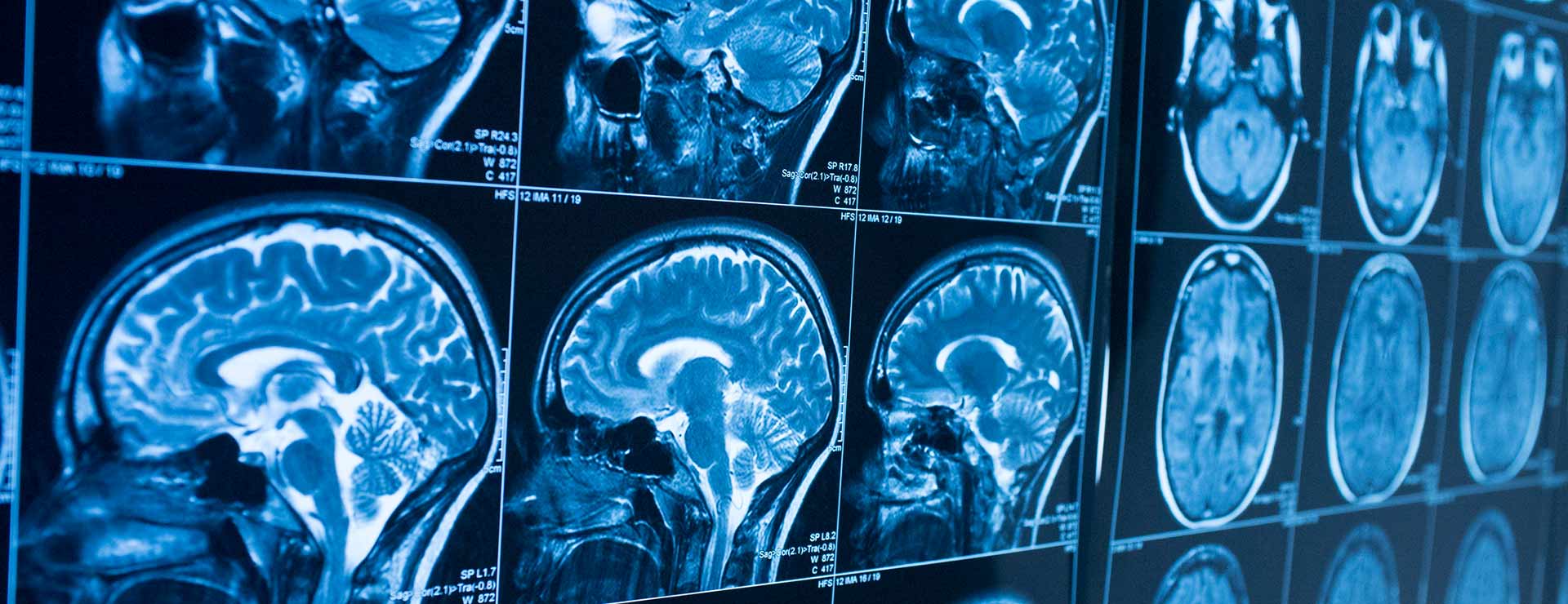 X ray scan of different portions of the skull and brain