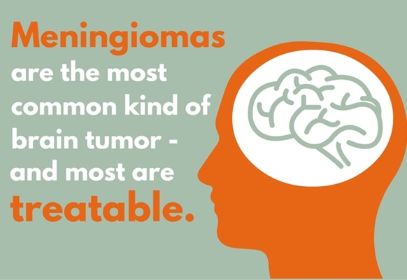 Meningiomas are the most common kind of brain tumor, and most are treatable.