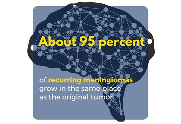 About 95 percent of recurring meningiomas grow in the same place as the original tumor