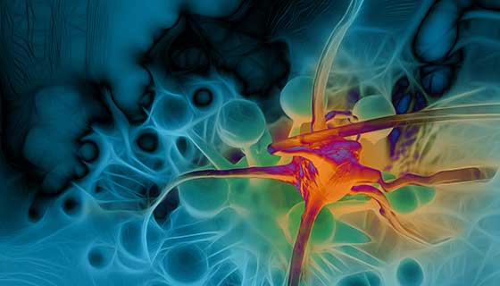 Metastatic brain tumor cell