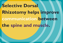 Selective dorsal rhizotomay helps improve communication between the spine and muscle.