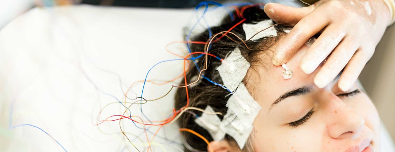Woman with electrodes on head undergoing wada testing