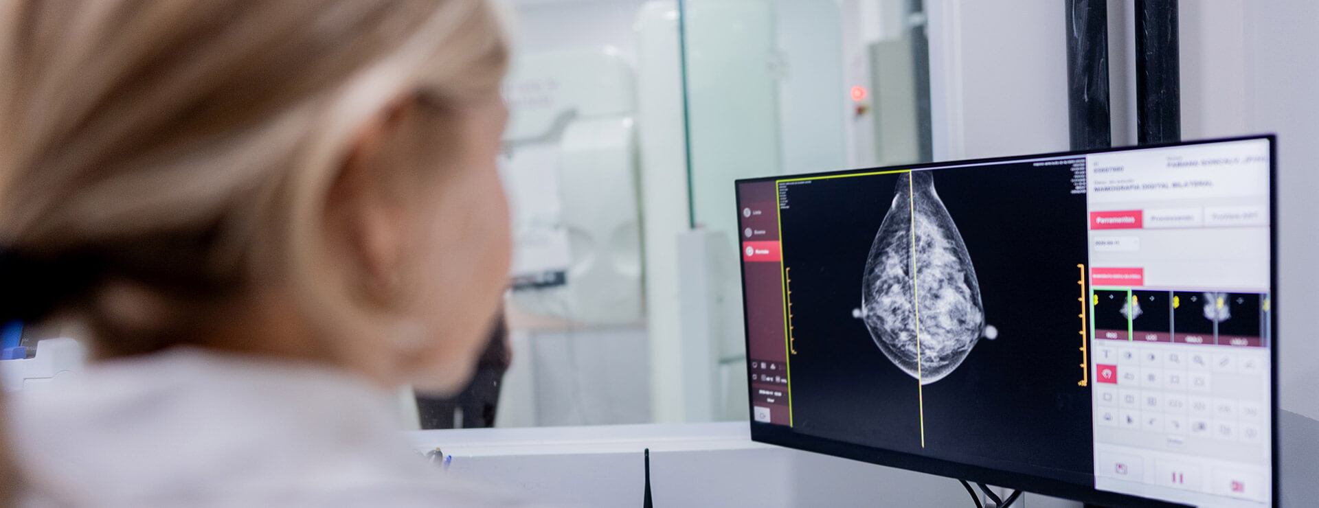 A doctor reviews a mammogram image