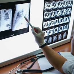 Doctor examines lung X-ray.