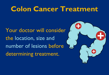 Colon Cancer Treatment: Your Doctor will consider the location, size and number of lesions before determining treatment