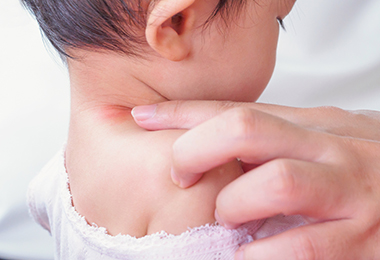 rash on child's skin