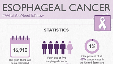 Snippet of esophageal cancer infographic