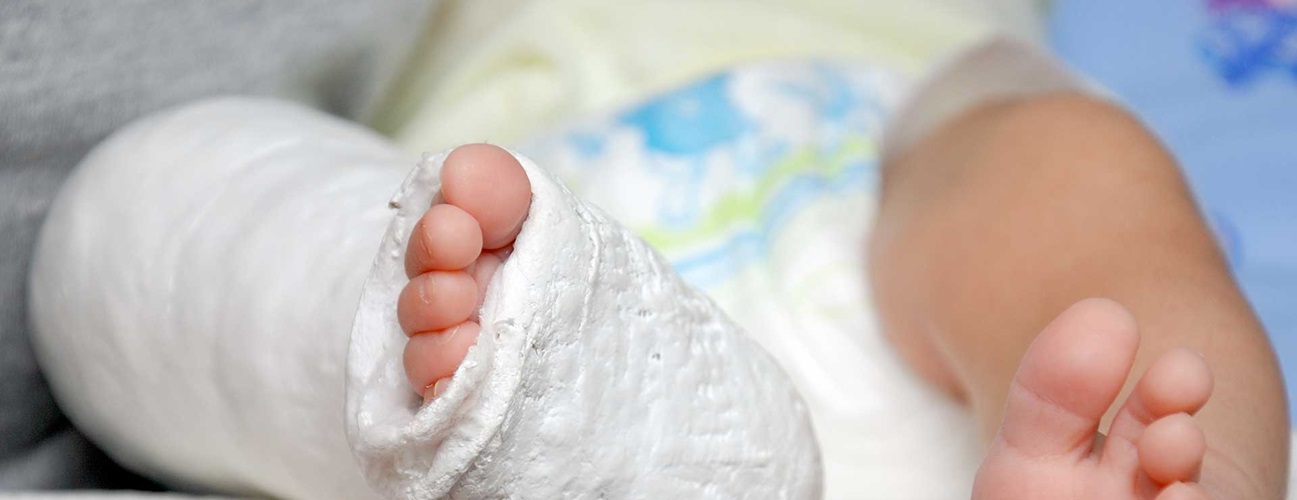 Baby feet and leg in cast