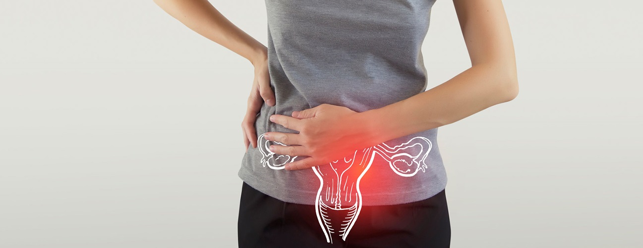 Cervicitis | Johns Hopkins Medicine