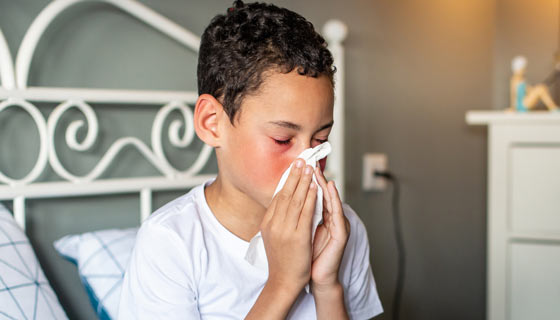 Boy with Fifth Disease sneezing into a tissue