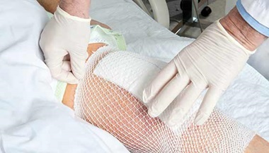 dressing a surgical wound