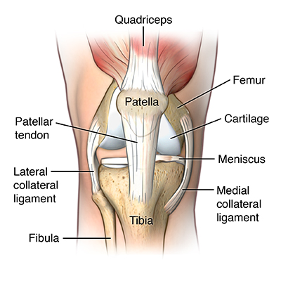 Patellar Tendonitis (Jumper's Knee)