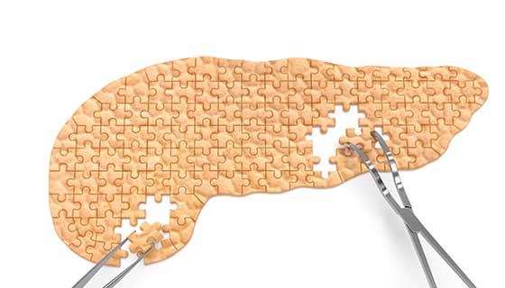 Illustrated pancreas puzzle