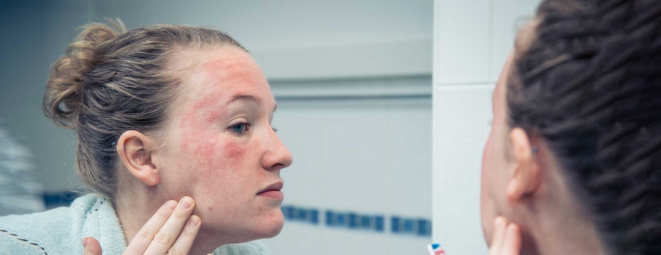 A young woman examines a facial rash in the mirror.