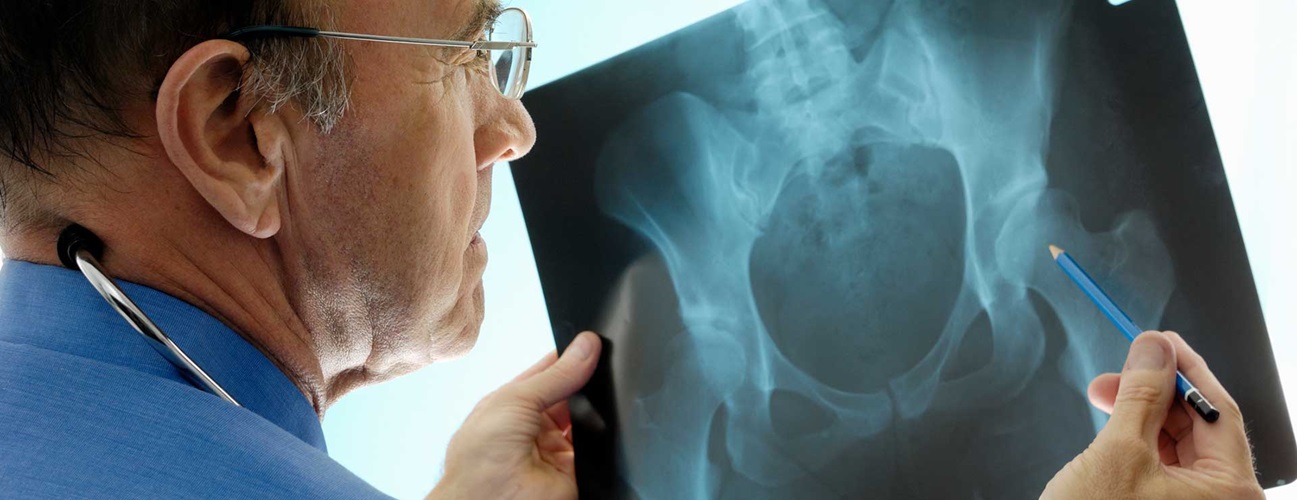 Doctor examining x-ray of hip