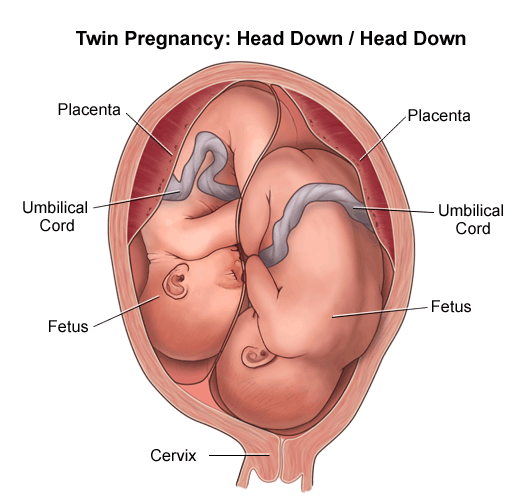 Illustration showing both twins with their heads down.