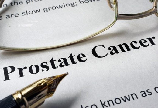 prostate cancer written on paper