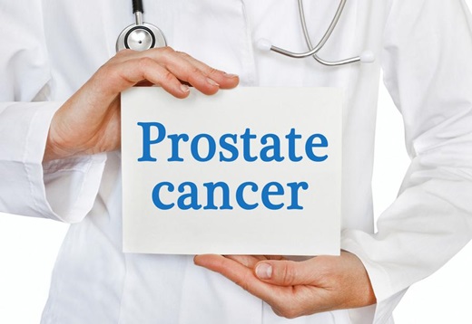 Physician holding a piece of paper that says, "Prostate cancer".