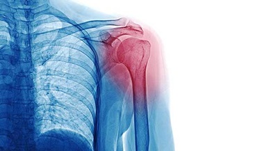 X-ray of the shoulder