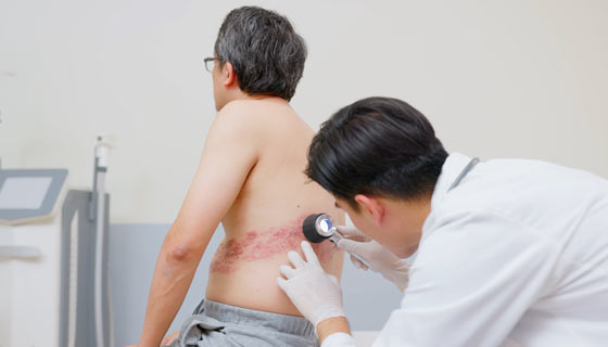 Doctor examining a patient with shingles