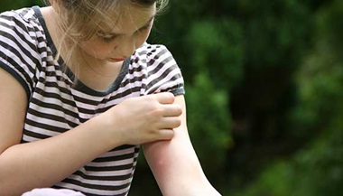 A young girl scratches at a spider bite on her arm.
