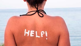 sunburned woman with help written in lotion