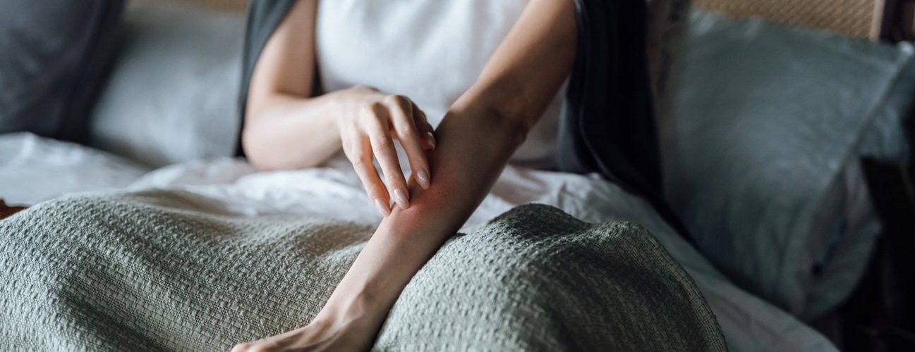 Contact Dermatitis | Johns Hopkins Medicine Contact Dermatitis | Johns Hopkins Medicine