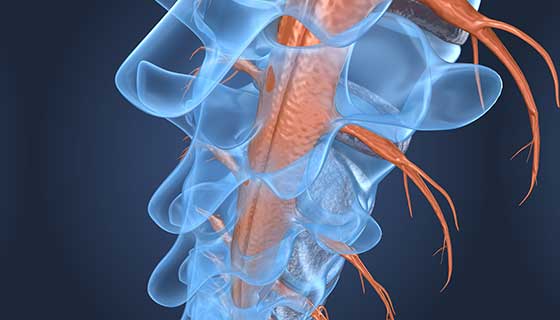 Cancer in the Spine Comprehensive Care 