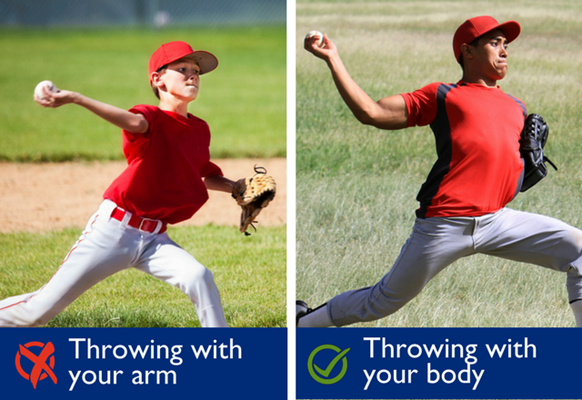 an example of throwing with your arm versus throwing with your body