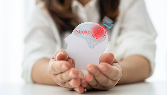 doctor in white coat holding a cutout of head with part of  brain marked as "stroke"