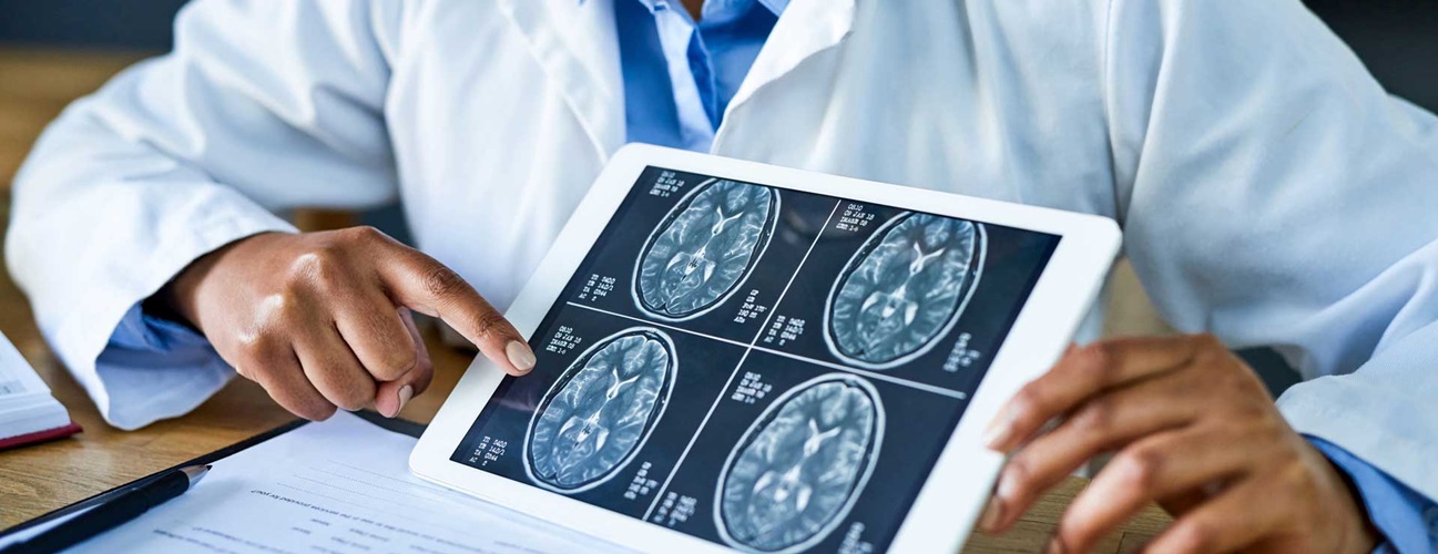 doctor holding brain scan