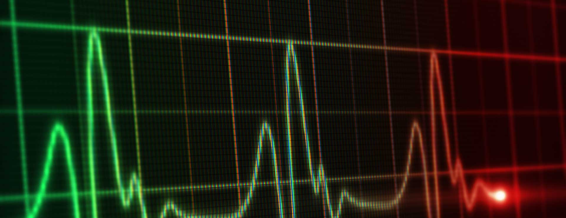 EKG reading