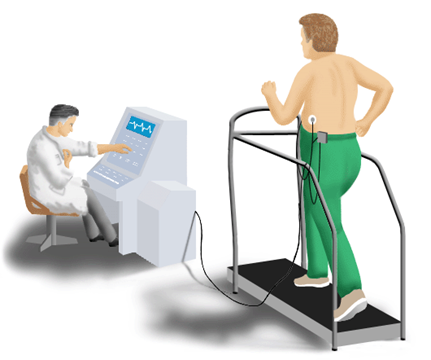 Illustration demonstrating an exercise ECG