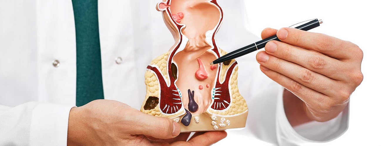 Provider pointing to an anatomical model of a rectum