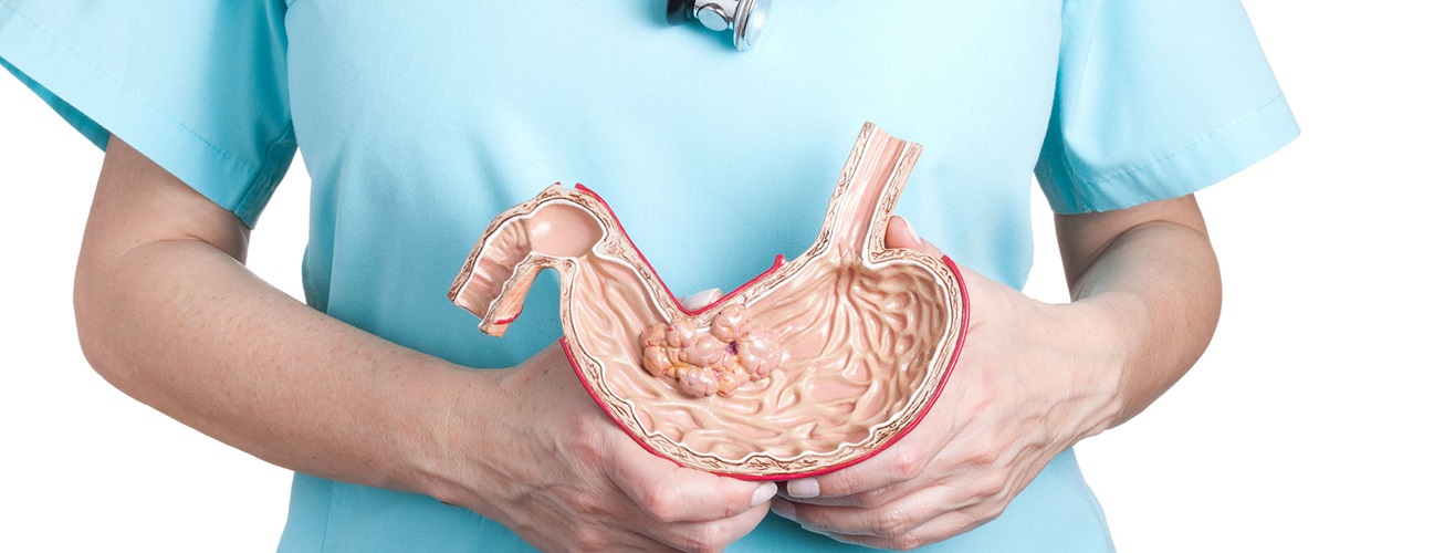 doctor holding a model of a stomach